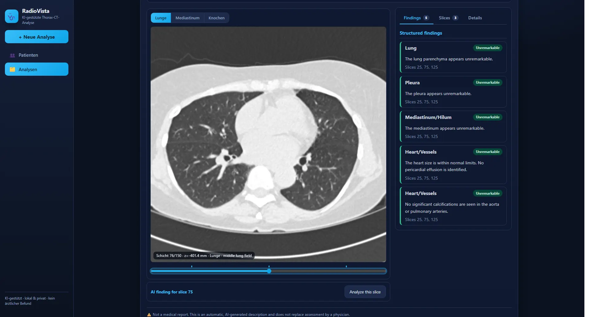 RadioVista Viewer mit CT-Thorax im Lungenfenster und strukturierten Befunden