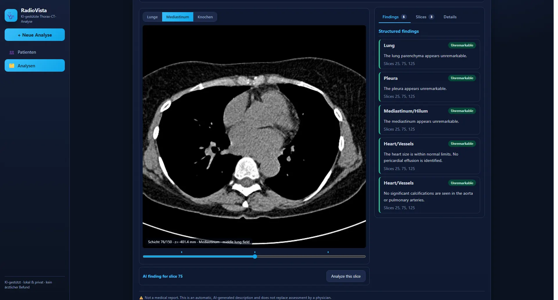 RadioVista: CT – Weichteilfenster (Mediastinum)