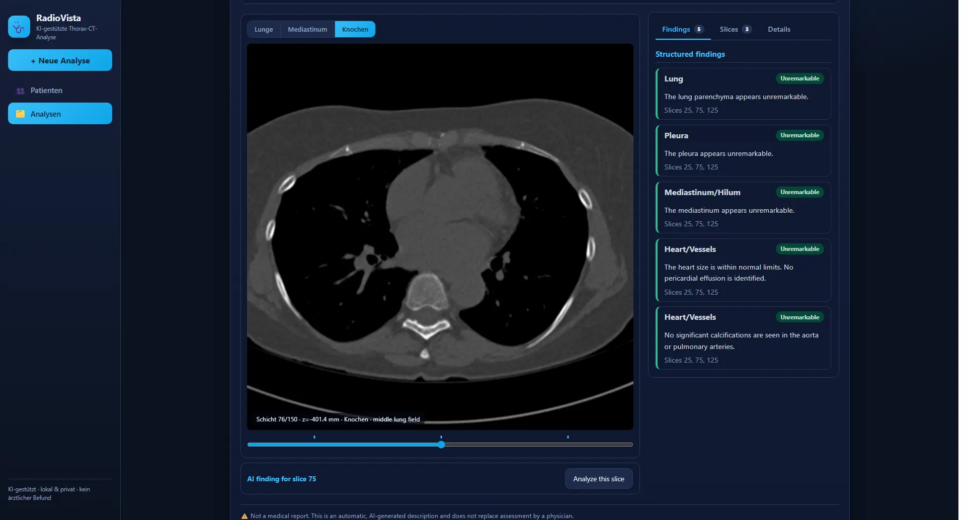 RadioVista CT-Schicht im Knochenfenster mit kantenscharfen Rippen und Wirbelkörpern