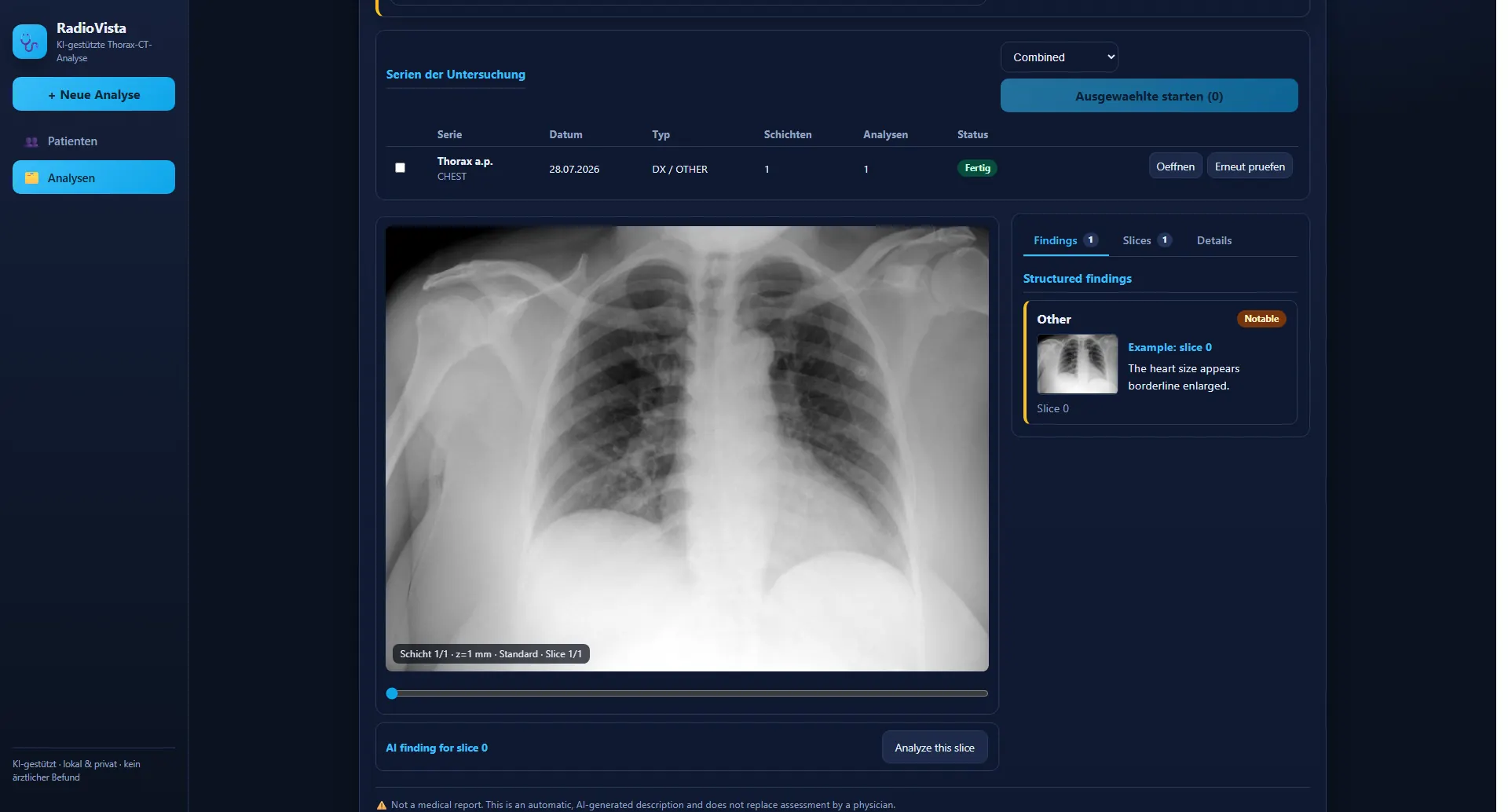 RadioVista: Röntgen – Thorax in der Detailansicht