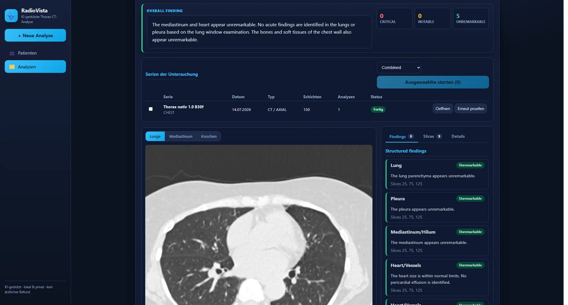RadioVista strukturierter KI-Bericht mit Einzelbefunden nach anatomischer Region
